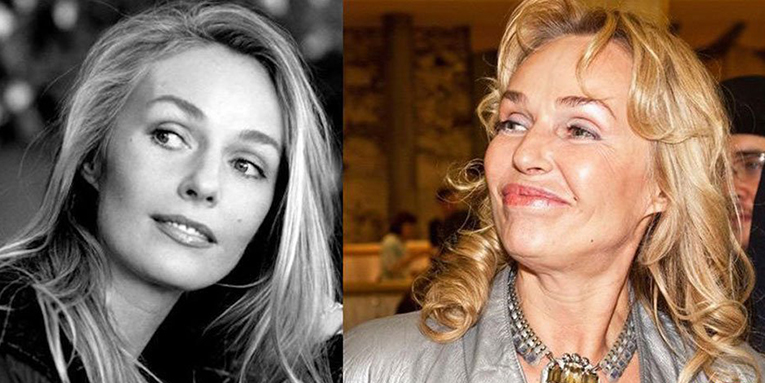 Российские знаменитости до и после пластики фото 19
