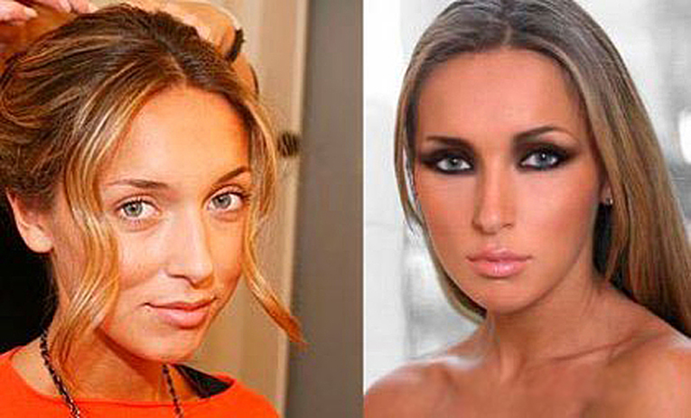 Российские знаменитости до и после пластики фото 21