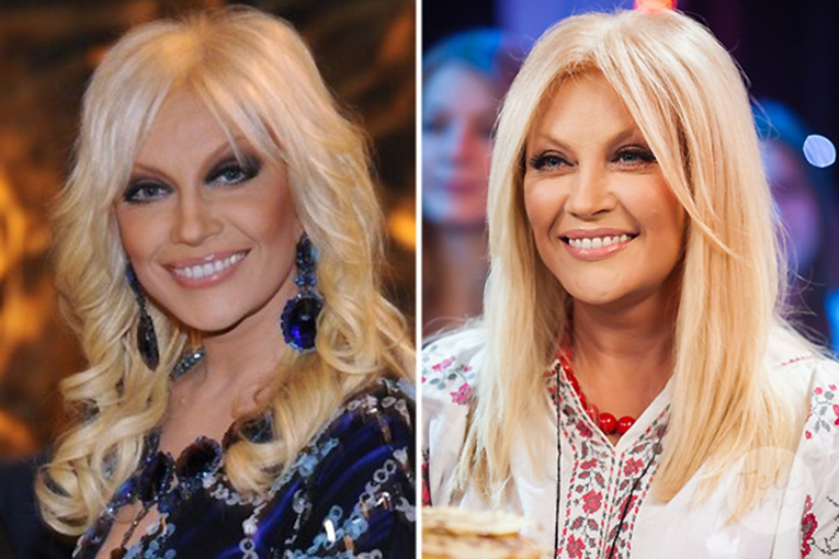 Российские знаменитости до и после пластики фото 23