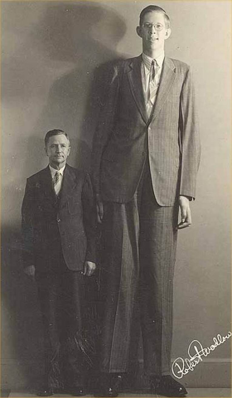 Самый высокий человек в мире фото 2
